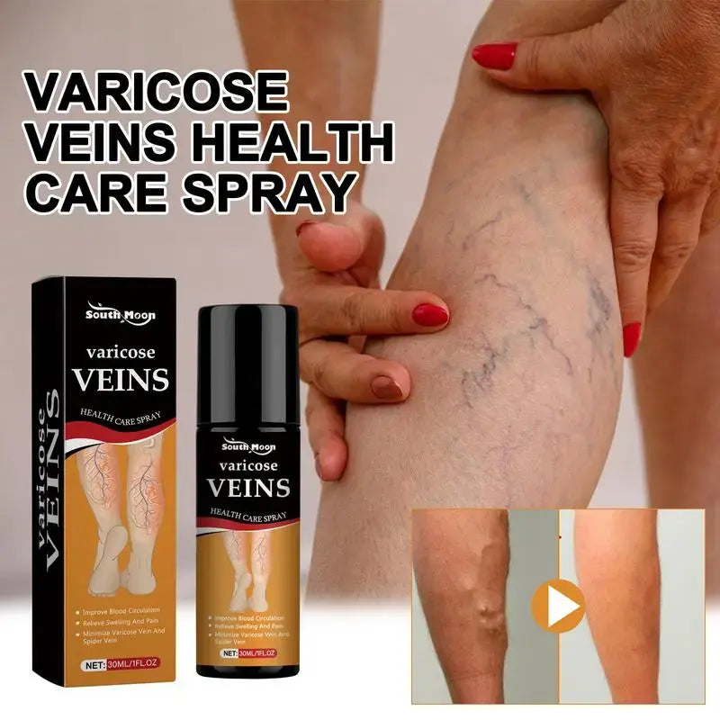 Varicose Veins Spray – Natural Herbal Formula for Fast Relief